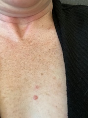 What is this on my chest?!