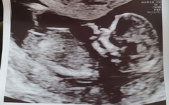 Just for fun, guess the sex!
