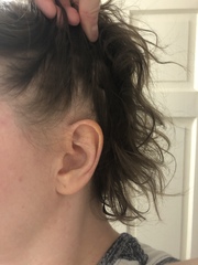 I think I might be losing my hair (Pics)