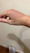 To be surprised people find cannulas painful