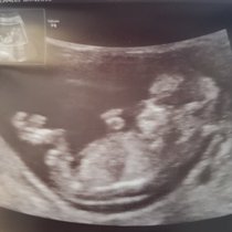 Gender guesses