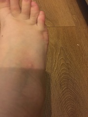 Does any one know what these spots are