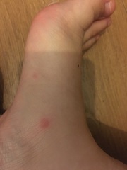 Does any one know what these spots are
