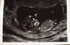 Boy or girl? :)