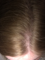 My hair..