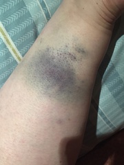 FFS. I'm such a clumsy arse.