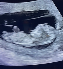 Just for fun- boy or girl