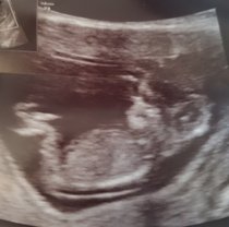 Gender guesses