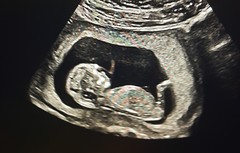 Nub/skull theory predictions wanted!