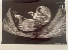 Any guesses - boy or girl?