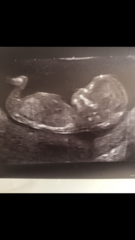 Boy or girl?