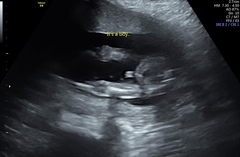 Is this definitely a boy?