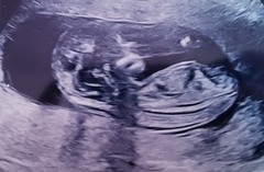 13 weeks any guesses