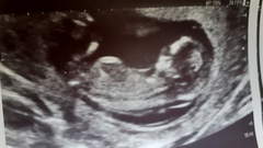 Boy or Girl? Guesses Please