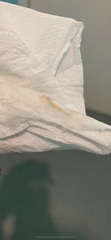 Brown vaginal discharge at 10 weeks