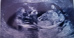 13 weeks any guesses