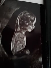 Girl or boy? Finding out soon!
