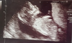Gender guesses - just for fun!