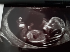 Girl or boy? Finding out soon!
