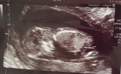 Gender guesses - just for fun!