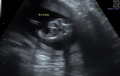 Is this definitely a boy?