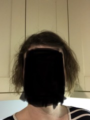 Having a hair crisis (pics)