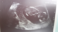 Boy or Girl? Guesses Please