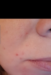 🐌 Fantastic Skincare: Jump through flaming hoops, repeat, 'Beauty is Pain', and acces to this thread will be unlocked