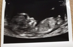 Are we allowed to post pics of our scans and ask for gender guesses/nub theory help? :)