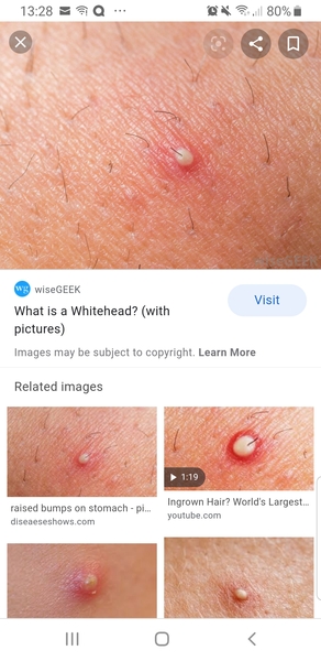 Spots on 6-year old's face