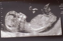 Nub guesses before we found out sex!