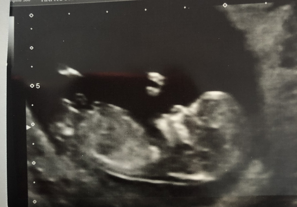 Is anyone else due on the 22nd may 2021?