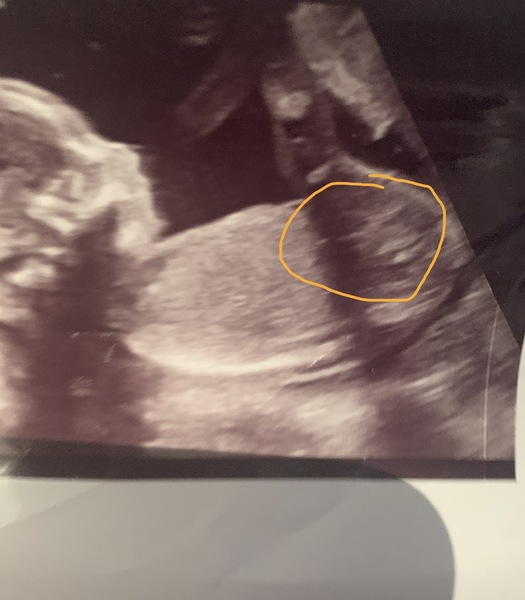 Gender guess
