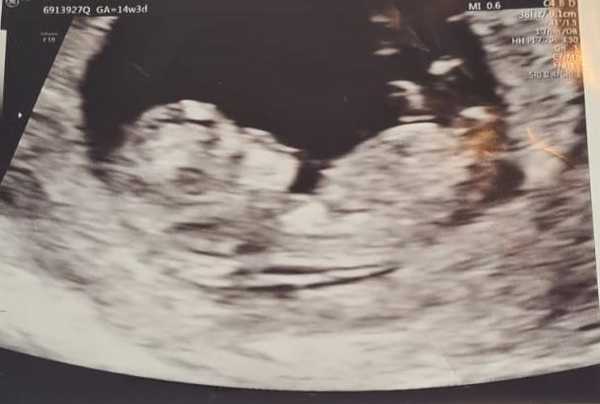 Boy or girl?