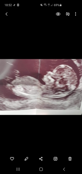 12+1 scan boy or girl?