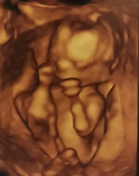 At Home Insemination - Buddies?