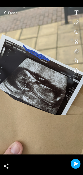 Boy or girl? Can you tell?
