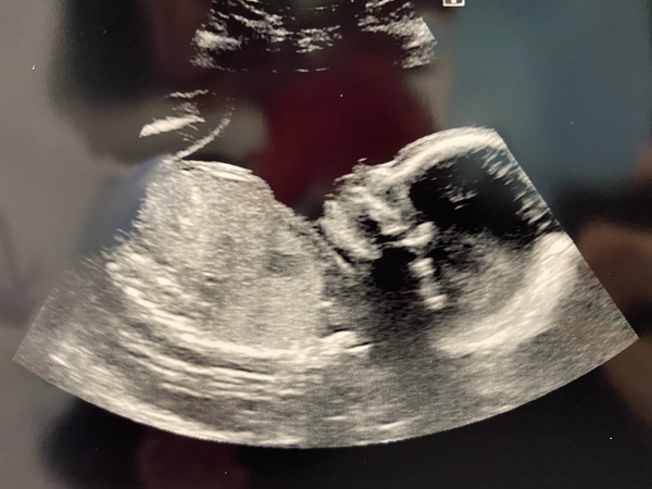 Scottish Mamas Due March - July 2021