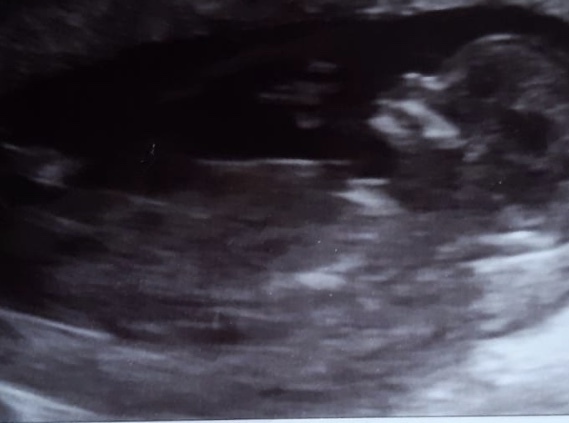Gender guesses!!!