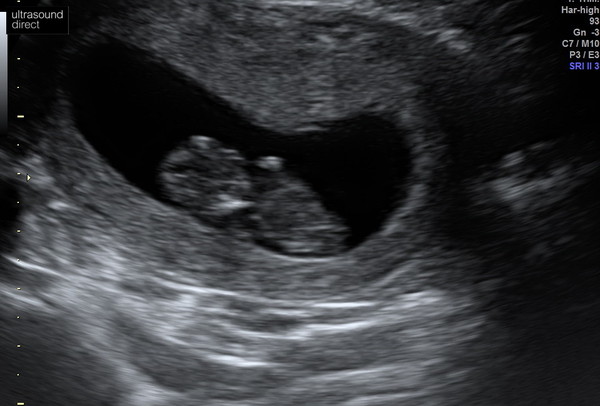 June 2021 thread 2