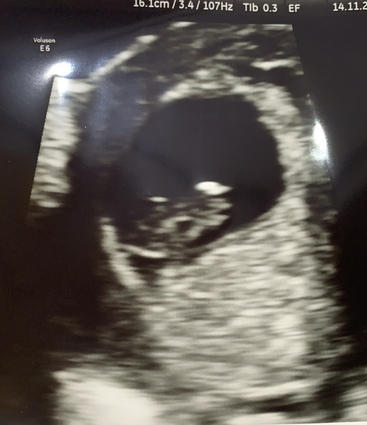 Is this a positive? Squinter?