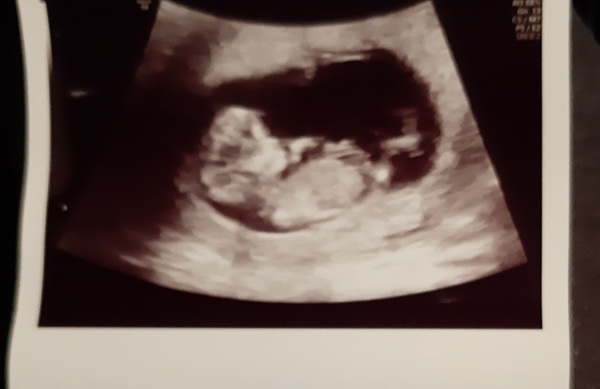June 2021 thread 2