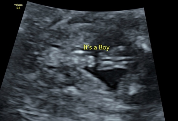 Gender