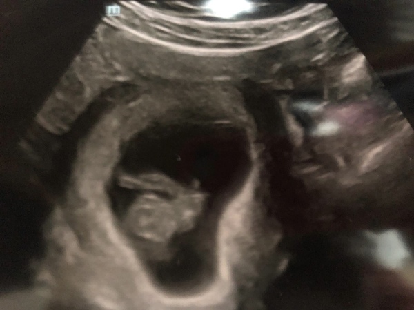 June 2021 thread 2