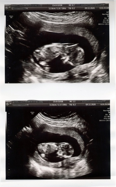 Is anyone else due on the 22nd may 2021?