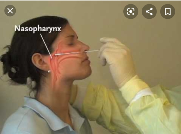 To ask where the swab goes?