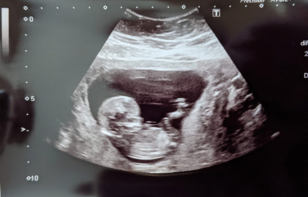 June 2021 part 3!