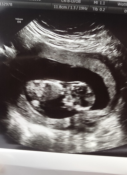 Is anyone else due on the 22nd may 2021?