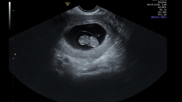 June 2021 thread 2