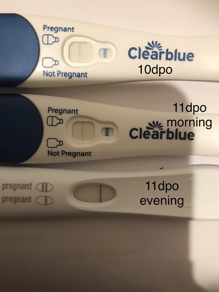 Support thread for women who are pregnant or TTC following a termination for abnormalities. Thread 7